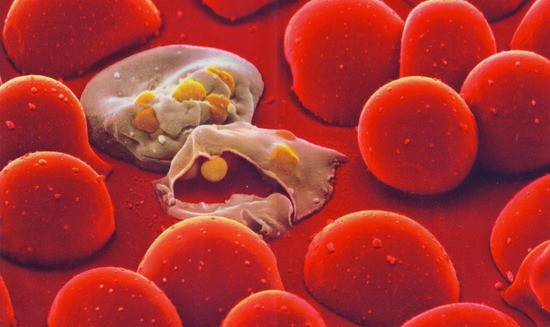 Malaria blood cell. 